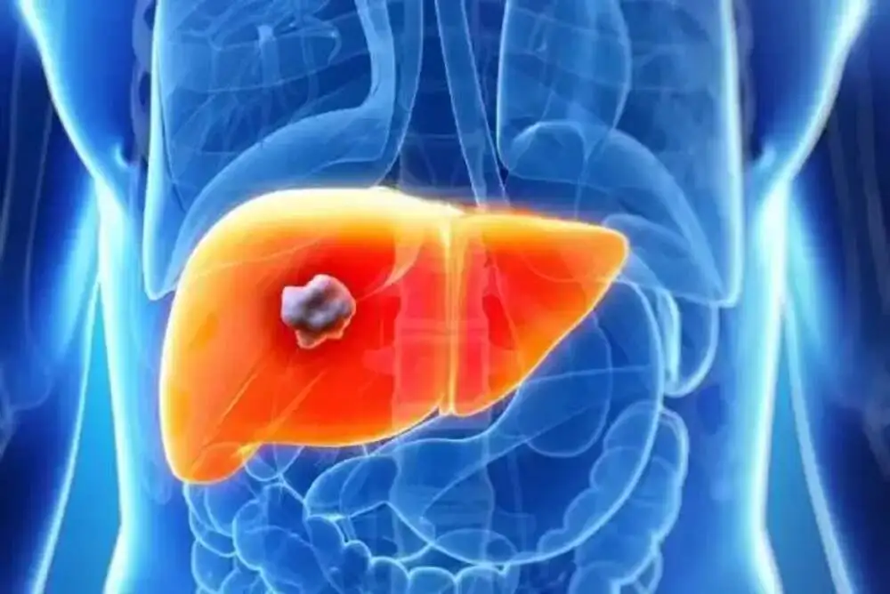 Liver Abscess Symptoms and When to Seek Emergency Care